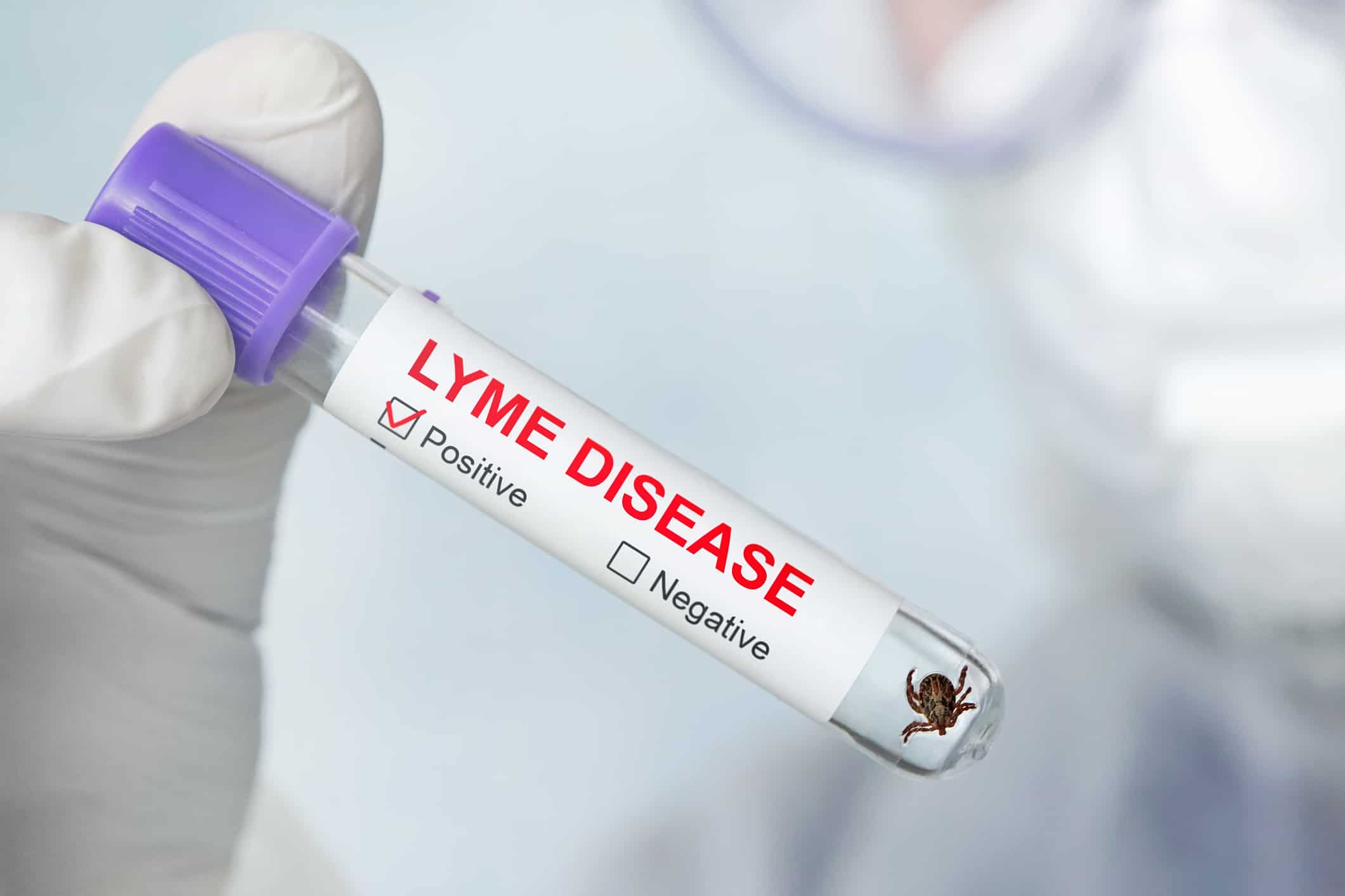 lyme-disease_in_tennessee