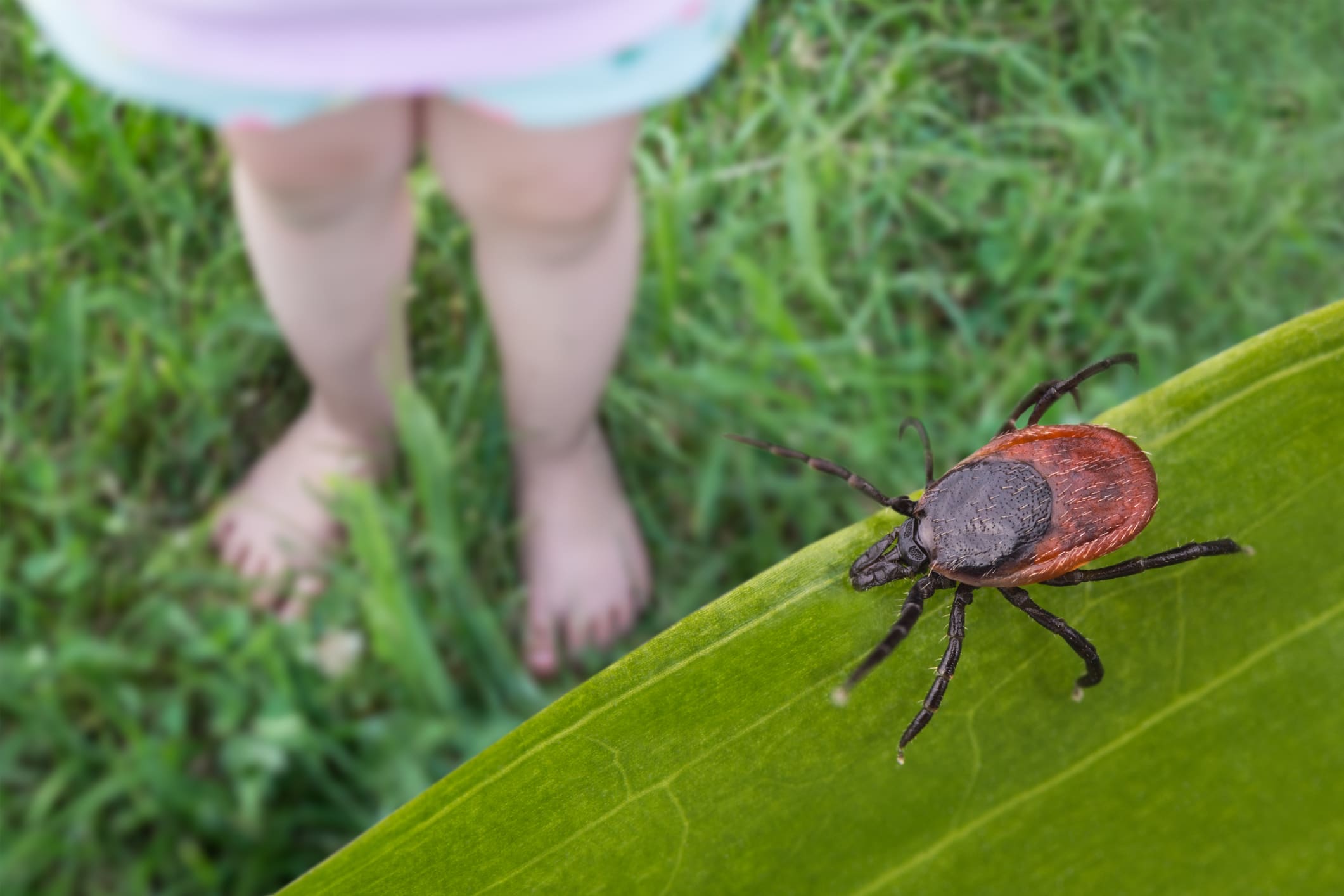 A tick with a reddish-brown and dark gray body sits on a green leaf blade, with a child's bare legs visible in the blurred background standing in tall grass, illustrating the risk of tick exposure in outdoor environments.