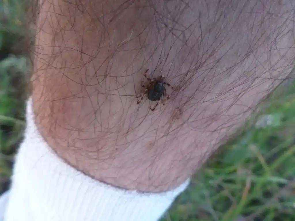 A Tick Put My Husband in the Emergency Room Twice 5 Infected tick biting a mans leg