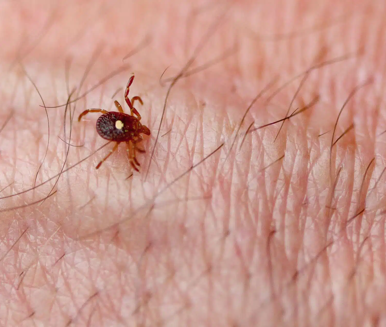 Lone Star Tick Biting a Human